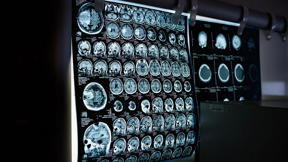 Imagem ilustrativa: Exame de imagem cerebral usado em pesquisa sobre o sistema nervoso